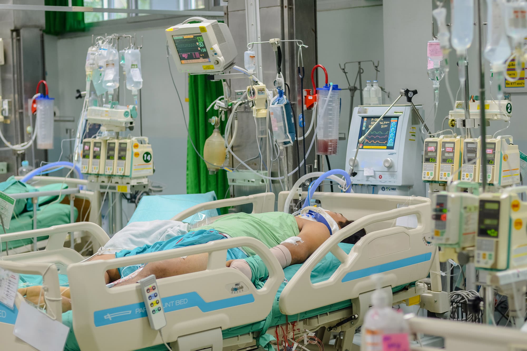 Patient with life saving equipment for treatment in ICU at the hospital.